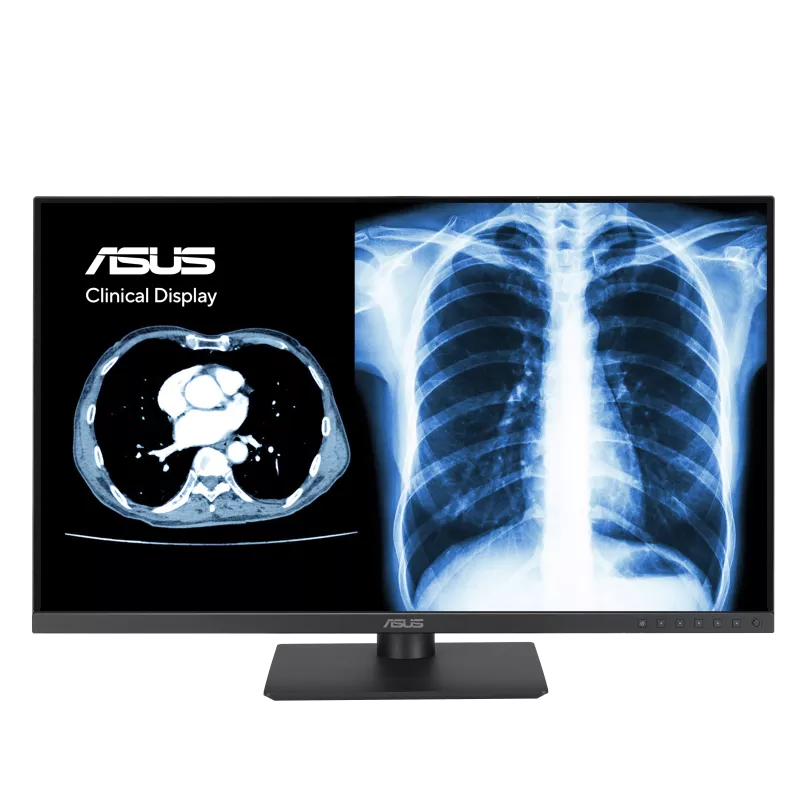ASUS MH2741A 27 inch clinical medical display for PACS review