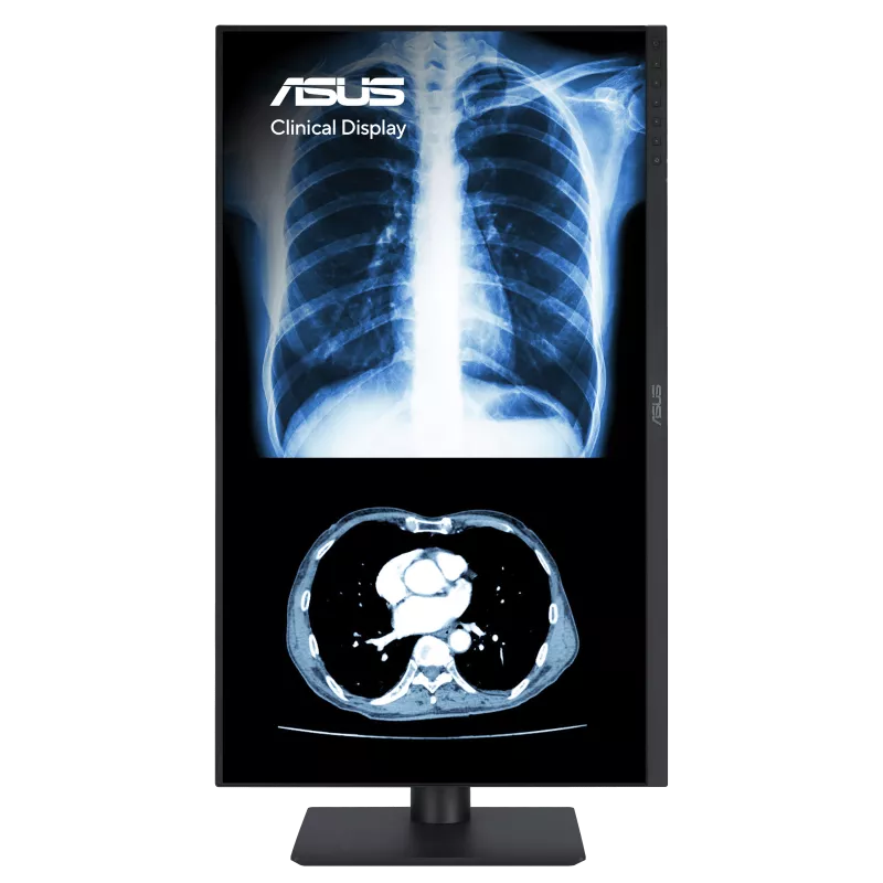 ASUS MH2741A clinical display shown in portrait orientation with a chest X-ray and CT slice